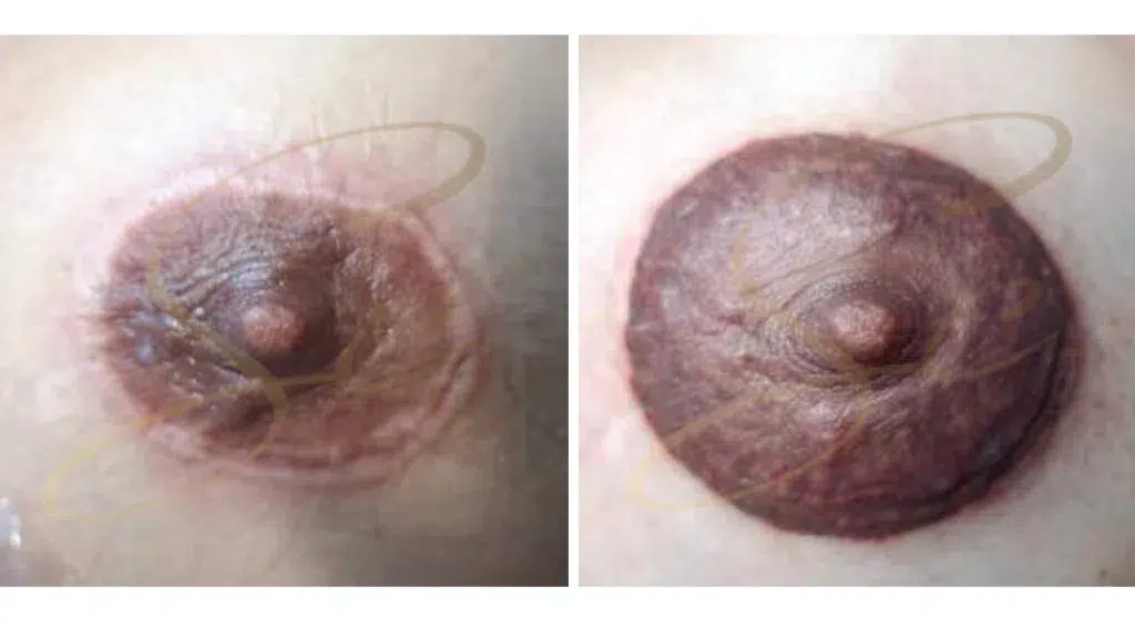 micropigmentacion-areola-csc-1024x576.png