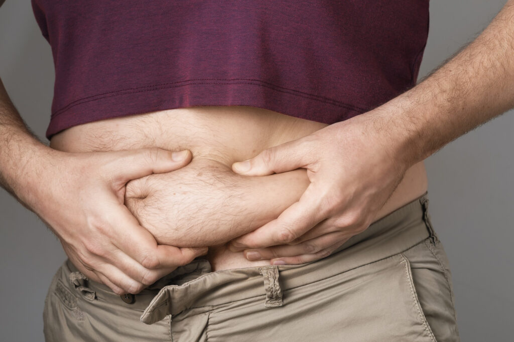 Necesitas abdominoplastia o liposucción