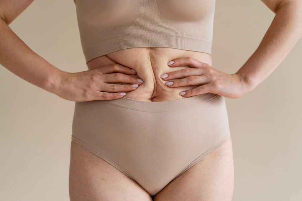 cómo curar la diástasis abdominal