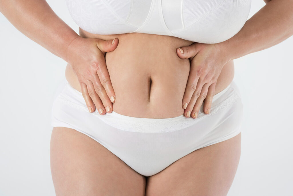 liposuccion de abdomen para mujer