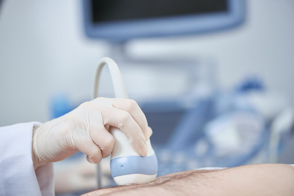 ecografía para identificar si se tiene diástiasis abdominal