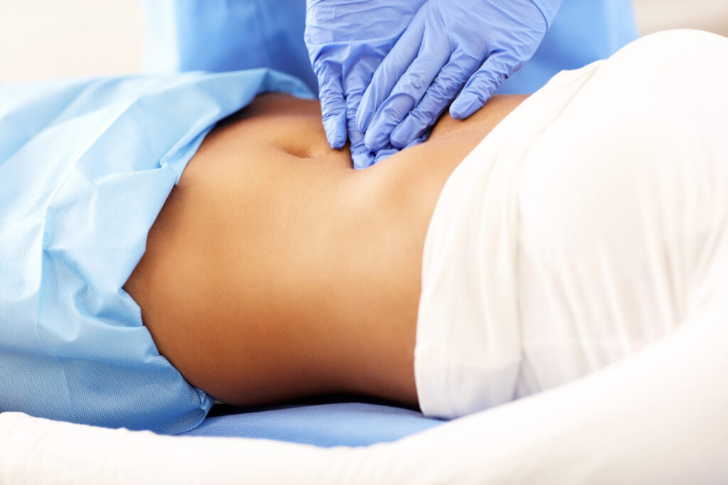 realizar abdominoplastia en una mujer