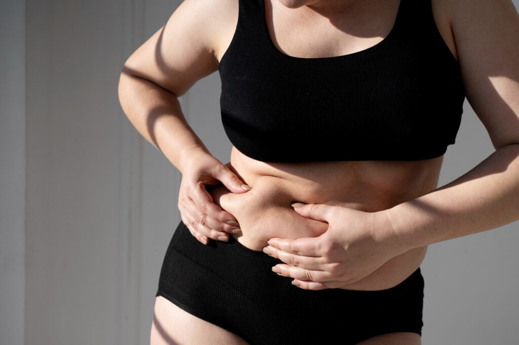 cómo se hace la liposucción