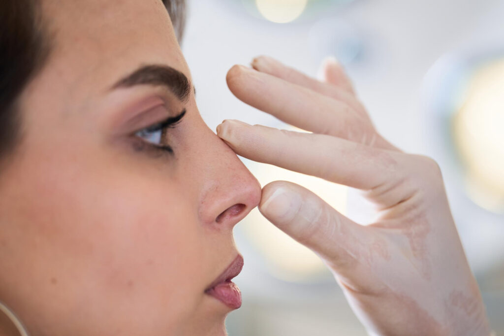 Costes de una rinoplastia en España